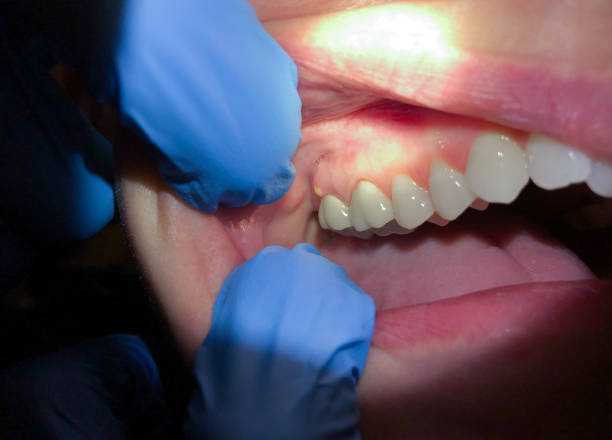 Best Emergency Treatment for Toothache in Kelso, WA
